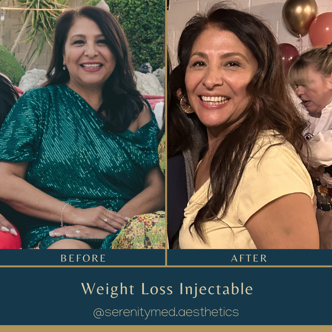 Before and after weight loss results — Patient 1