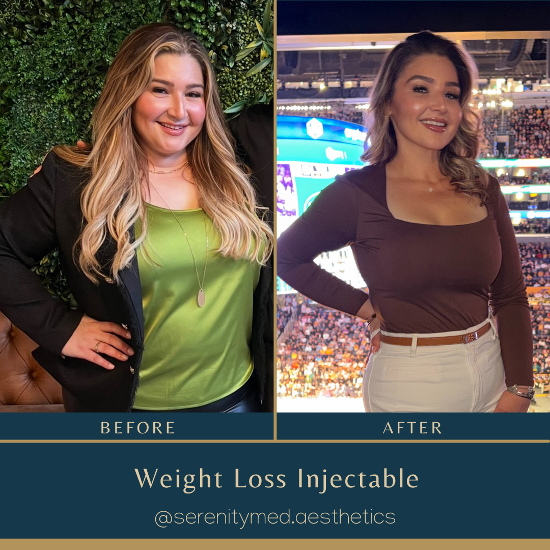 Before and after weight loss results — Patient 2